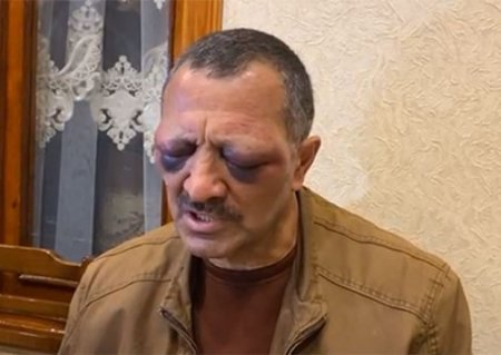 Tofiq Yaqublu prokurorluğa çağırıldı0