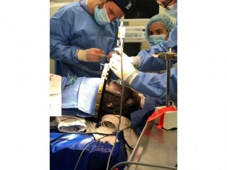 Donuzdan köçürülən  beyin hüceyrələri dəniz  pişiyinin epilepsiyasına əlac oldu- SIRADA İNSANLAR VAR